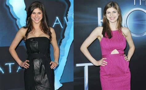 did alexandra daddario get a boob job|Alexandra Daddario Plastic Surgery Before and After